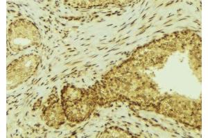 ABIN6277290 at 1/100 staining Mouse colon tissue by IHC-P. (FES anticorps  (C-Term))