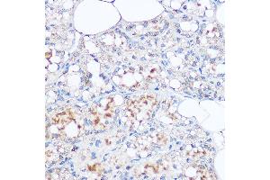 Immunohistochemistry of paraffin-embedded rat breast using MGP Rabbit pAb (ABIN6128268, ABIN6143825, ABIN6143826 and ABIN6221090) at dilution of 1:100 (40x lens). (MGP anticorps  (AA 20-103))