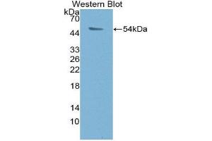 Western Blotting (WB) image for anti-Proteasome (Prosome, Macropain) 26S Subunit, ATPase, 1 (PSMC1) (AA 1-440) antibody (ABIN3204524) (PSMC1 anticorps  (AA 1-440))