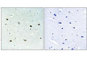 Immunohistochemical staining of human brain (left). (MAPK15 anticorps  (pThr175, pTyr177))