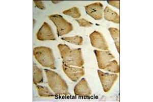 Formalin-fixed and paraffin-embedded human Skeletal muscle reacted with MF Antibody (C-term), which was peroxidase-conjugated to the secondary antibody, followed by DAB staining.