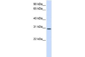 WB Suggested Anti-KIAA0247 Antibody Titration:  0. (SUSD6/KIAA0247 anticorps  (N-Term))
