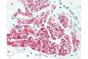 Anti-L1CAM antibody IHC staining of human peripheral nerve. (L1CAM anticorps  (AA 1154-1182))