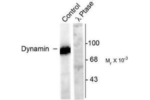 Image no. 1 for anti-Dynamin 1 (DNM1) (pSer778) antibody (ABIN372617) (Dynamin 1 anticorps  (pSer778))