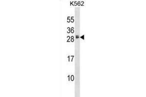 Western Blotting (WB) image for anti-Heparin-Binding EGF-Like Growth Factor (HBEGF) antibody (ABIN2998267)
