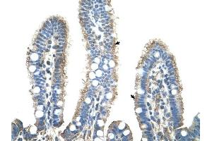 APCS antibody was used for immunohistochemistry at a concentration of 4-8 ug/ml to stain Epithelial cells of intestinal villus (arrows) in Human Intestine.