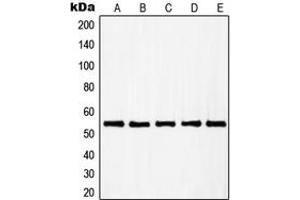 Western blot analysis of RAD23B expression in A431 (A), HuvEc (B), HEK293 (C), HeLa (D), HT29 (E) whole cell lysates. (RAD23B anticorps  (N-Term))