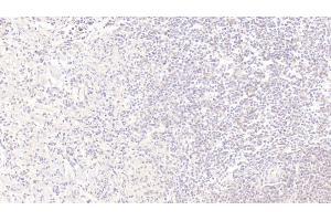 Detection of IGFBP1 in Human Spleen Tissue using Monoclonal Antibody to Insulin Like Growth Factor Binding Protein 1 (IGFBP1)