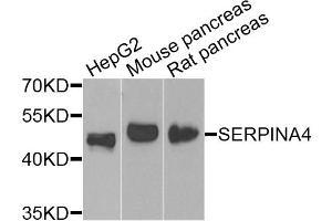 Western blot analysis of extracts of various cell lines, using SERPINA4 antibody (ABIN4905121) at 1:1000 dilution. (SERPINA4 anticorps)