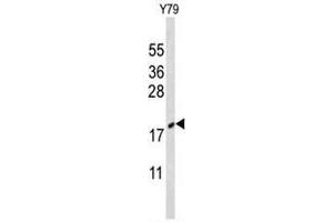 Western blot analysis of CIRBP Antibody (C-term) in Y79 cell line lysates (35µg/lane).