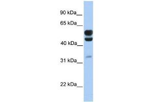 Human Brain; WB Suggested Anti-C3orf64 Antibody Titration: 0.