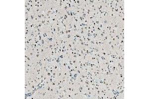 IHC analysis of SNRPD2 using anti-SNRPD2 antibody (ABIN7598963). (SNRPD2 anticorps  (AA 1-118))