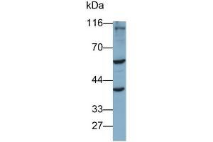 ANGPTL3 antibody  (AA 22-281)