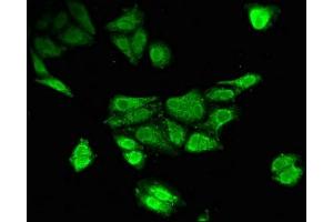 Immunofluorescent analysis of HepG2 cells using ABIN7173617 at dilution of 1:100 and Alexa Fluor 488-congugated AffiniPure Goat Anti-Rabbit IgG(H+L)
