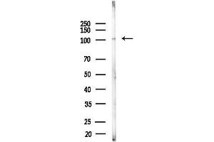 Western blot analysis of lysates from PC12 cells(uv30 min treatment), using INPP4B Antibody at 1/1000 dilution.