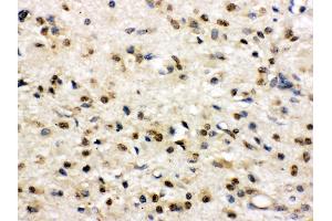 Immunohistochemistry (Paraffin-embedded Sections) (IHC (p)) image for anti-Discs, Large Homolog 4 (Drosophila) (DLG4) (AA 581-724) antibody (ABIN3043563)