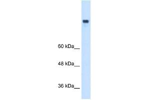 MTTP antibody used at 1 ug/ml to detect target protein.