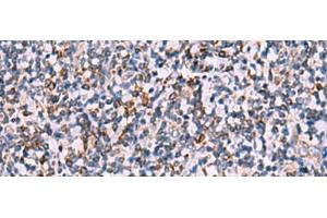 Immunohistochemistry of paraffin-embedded Human tonsil tissue using IPPK Polyclonal Antibody at dilution of 1:30(x200) (IPPK anticorps)