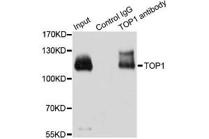 Immunoprecipitation analysis of 200ug extracts of HeLa cells using 3ug TOP1 antibody. (Topoisomerase I anticorps)