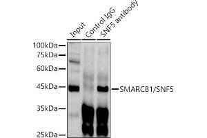 Immunoprecipitation analysis of 300 μg extracts of HeLa cells using 3 μg SM/SNF5 antibody .