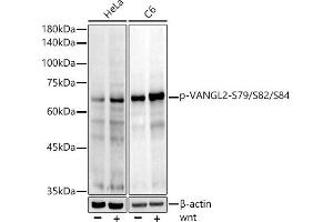 Western blot analysis of extracts of various cell lines, using Phospho-V-S79/S82/S84 Rabbit mAb antibody (ABIN7271290) at 1:1000 dilution. (VANGL2 anticorps  (pSer79, pSer82, pSer84))