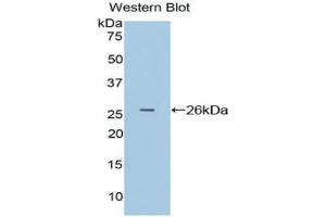Western blot analysis of the recombinant protein. (APC anticorps  (AA 2634-2842))