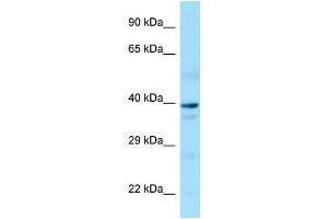 Western Blotting (WB) image for anti-Guanine Nucleotide Binding Protein (G Protein), alpha 14 (GNa14) (N-Term) antibody (ABIN2790107) (GNa14 anticorps  (N-Term))
