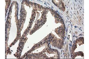 Image no. 12 for anti-Destrin (Actin Depolymerizing Factor) (DSTN) antibody (ABIN1497910) (Destrin anticorps)