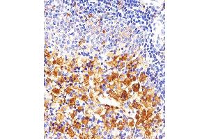 Immunohistochemical analysis of paraffin-embedded R. (FYN anticorps)