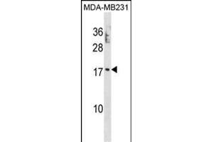 PTRH2 Antibody (N-term) (ABIN1881706 and ABIN2839089) western blot analysis in MDA-M cell line lysates (35 μg/lane). (PTRH2 anticorps  (N-Term))