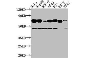 Western Blot Positive WB detected in: Hela whole cell lysate, HepG2 whole cell lysate, MCF-7 whole cell lysate, A549 whole cell lysate, PC3 whole cell lysate, 293T whole cell lysate, K562 whole cell lysate All lanes: SLC3A2 antibody at 1:2000 Secondary Goat polyclonal to rabbit IgG at 1/50000 dilution Predicted band size: 68, 58, 62, 72 kDa Observed band size: 68 kDa (SLC3A2 anticorps  (AA 404-630))