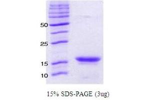 Figure annotation denotes ug of protein loaded and % gel used. (alpha Synuclein A53T (active) Protéine)