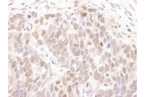 Immunohistochemistry (IHC) image for anti-Casein Kinase 2 alpha 1 (CSNK2A1) (C-Term) antibody (ABIN7453947) (CSNK2A1/CK II alpha anticorps  (C-Term))