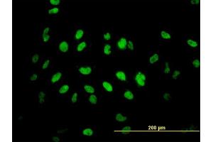 Immunofluorescence of monoclonal antibody to TLK2 on HeLa cell. (TLK2 anticorps  (AA 1-126))