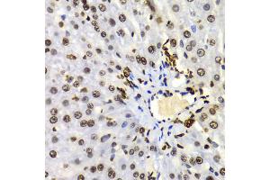 Immunohistochemistry of paraffin-embedded Rat liver using Dimethyl-Histone H3-K4 antibody (ABIN5969803) at dilution of 1/100 (40x lens). (Histone 3 anticorps  (H3K4me2))