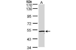 WB Image Sample (20 ug of whole cell lysate) A: Hep G2 , membrane extract 7.