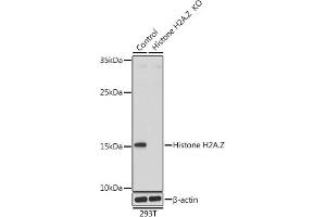 Western blot analysis of extracts from normal (control) and Histone H2A. (Histone H2A anticorps  (AA 1-128))