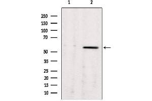 Western blot analysis of extracts from rat brain, using ALDH7A1 antibody.