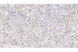 Detection of HB in Canine Spleen Tissue using Polyclonal Antibody to Hemoglobin (HB) (Hemoglobin anticorps)