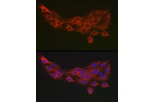Immunofluorescence analysis of PC-12 cells using PDK1/PDHK1 Rabbit pAb (ABIN3015351, ABIN3015352, ABIN1681301, ABIN5663787 and ABIN6214001) at dilution of 1:100 (40x lens). (PDPK1 anticorps  (AA 1-150))