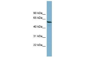 WB Suggested Anti-PGM3 Antibody Titration: 0. (Phosphoglucomutase 3 anticorps  (Middle Region))
