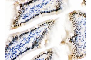 ZBTB7A was detected in paraffin-embedded sections of mouse intestine tissues using rabbit anti- ZBTB7A Antigen Affinity purified polyclonal antibody at 1 μg/mL.