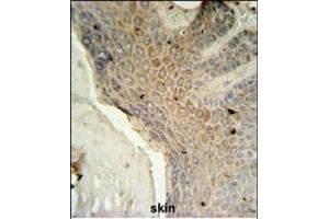 MFSD3 Antibody (Center) (ABIN651438 and ABIN2840241) IHC analysis in formalin fixed and paraffin embedded human skin tissue followed by peroxidase conjugation of the secondary antibody and DAB staining. (MFSD3 anticorps  (AA 174-202))