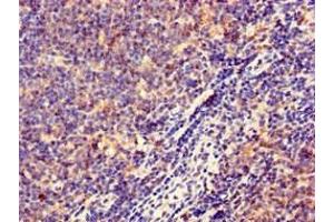 Immunohistochemistry of paraffin-embedded human lymph node tissue using ABIN7155597 at dilution of 1:100 (HLA-DQB1 anticorps  (AA 128-175))