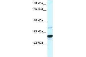 WB Suggested Anti-Cdx1 Antibody Titration: 1. (CDX1 anticorps  (C-Term))