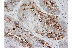 Image no. 1 for anti-BAI1-Associated Protein 2 (BAIAP2) antibody (ABIN1496805) (BAIAP2 anticorps)