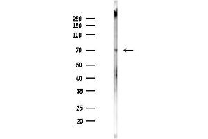 Western blot analysis of lysates from Rat brain, using IL-1R alpha /C alpha Antibody at 1/1000 dilution.