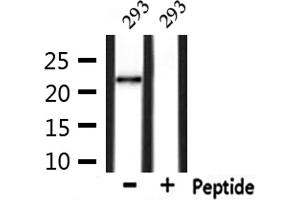 Western blot analysis of extracts from 293, using GPX4 Antibody. (GPX4 anticorps  (C-Term))