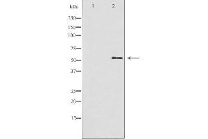 Western blot analysis of extracts from HuvEc cells, using GBA3 antibody. (GBA3 anticorps  (Internal Region))