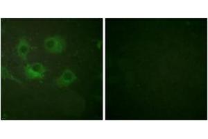 Immunofluorescence analysis of HuvEc cells, using Claudin 3 Antibody.